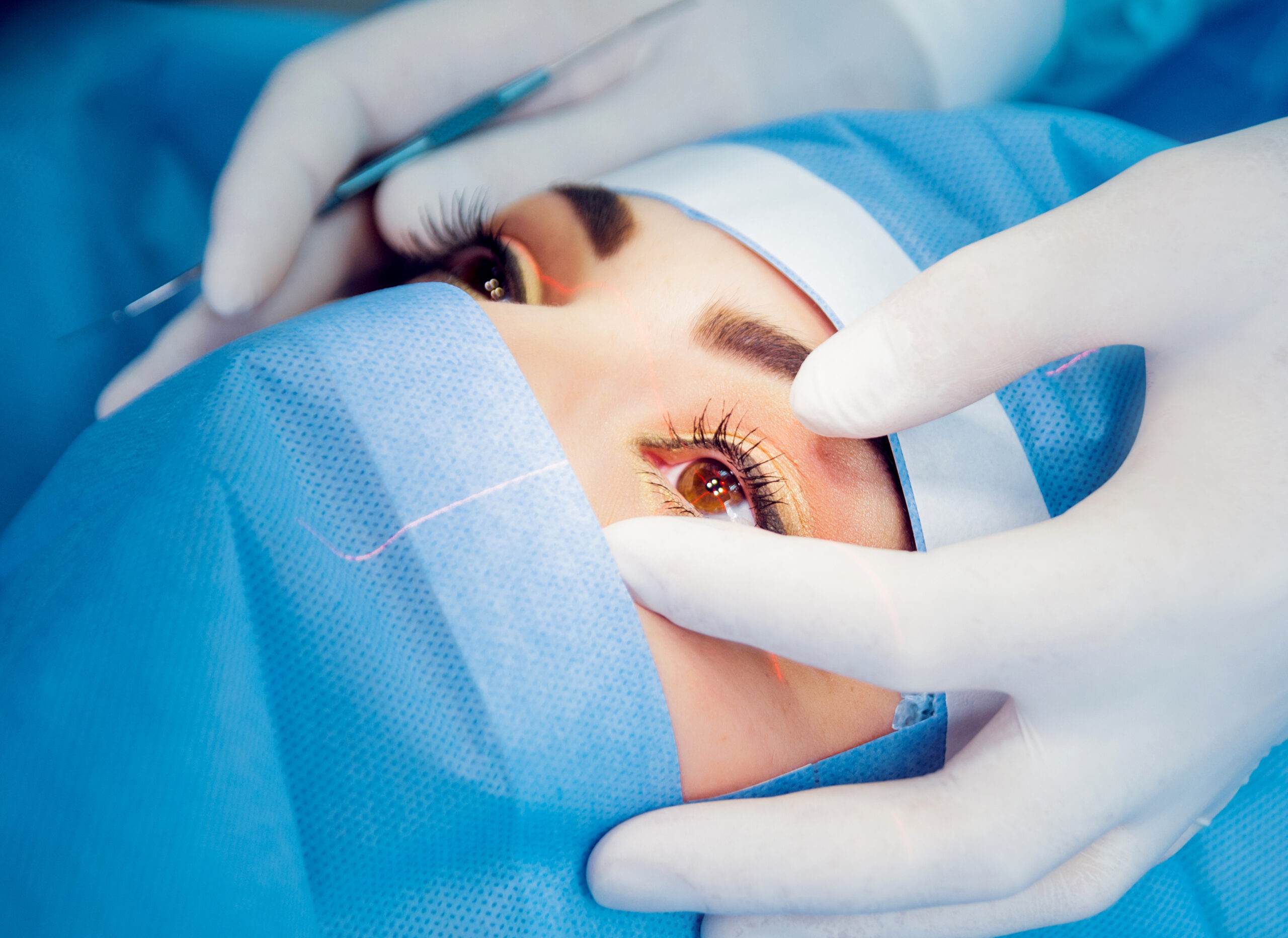 Laser Eye Surgery Australia